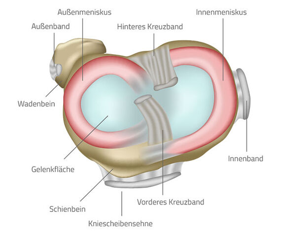 Grafische Darstellung eines Meniskus Grafische Darstellung eines Meniskus