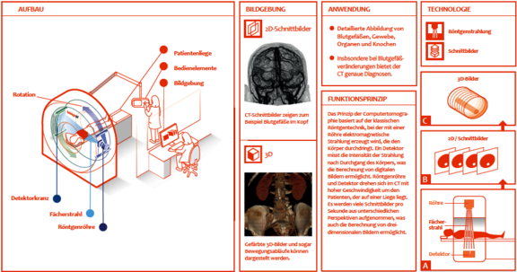 Die Computertomographie (CT)