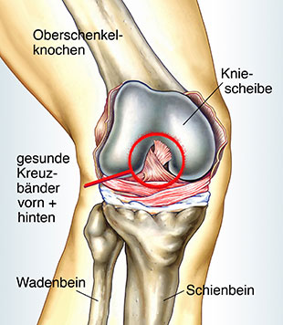 Illustration eines gesunden Kreuzbandes Illustration eines gesunden Kreuzbandes