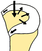 Die mechanische Funktion des Meniskus Die mechanische Funktion des Meniskus