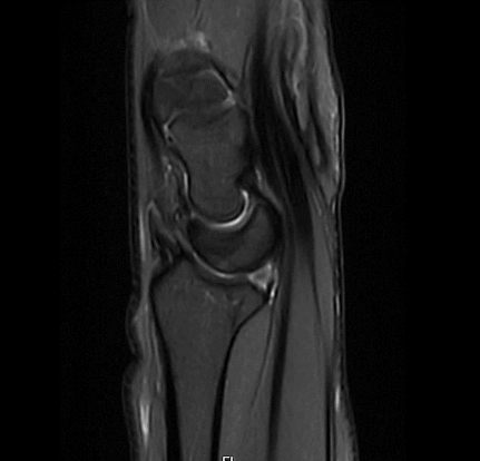 MRT Aufnahme Handgelenk - sagittal